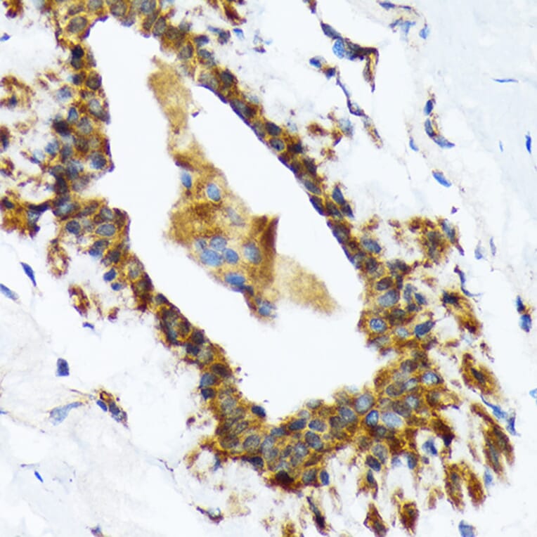 Immunohistochemistry - Anti-RAIDD Antibody [ARC1771] (A305654) - Antibodies.com