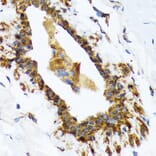 Immunohistochemistry - Anti-RAIDD Antibody [ARC1771] (A305654) - Antibodies.com