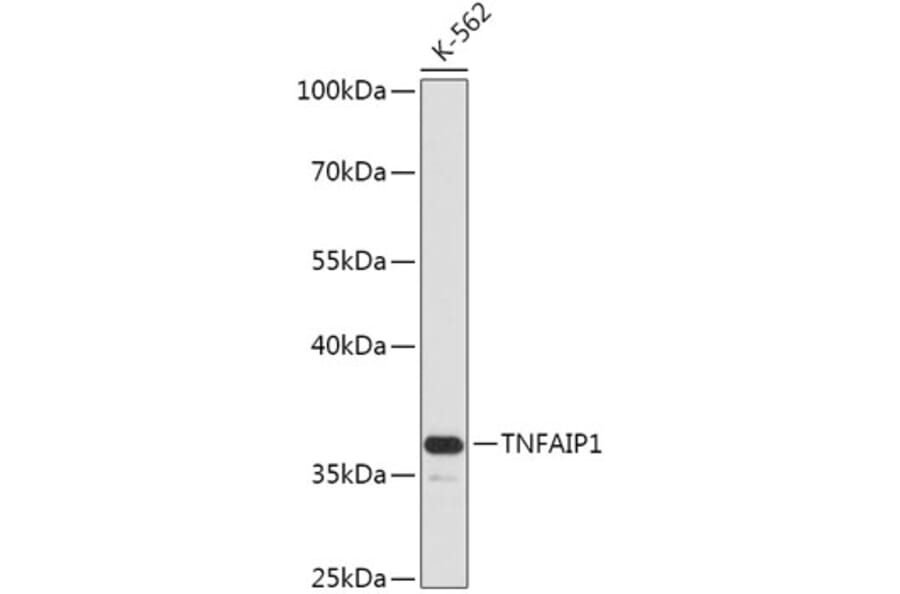 Western Blot - Anti-TNFAIP1 Antibody (A305655) - Antibodies.com