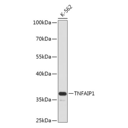 Western Blot - Anti-TNFAIP1 Antibody (A305655) - Antibodies.com