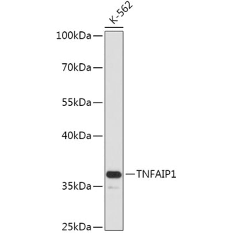 Western Blot - Anti-TNFAIP1 Antibody (A305655) - Antibodies.com
