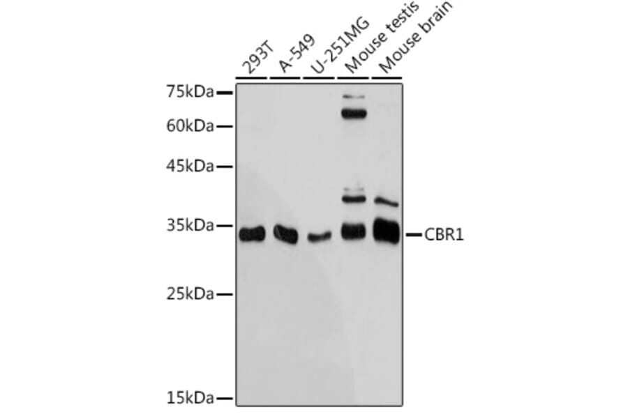 Western Blot - Anti-CBR1 Antibody [ARC2432] (A305656) - Antibodies.com