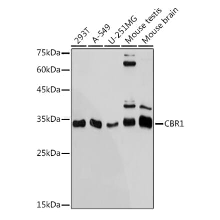 Western Blot - Anti-CBR1 Antibody [ARC2432] (A305656) - Antibodies.com