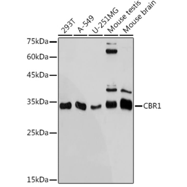 Western Blot - Anti-CBR1 Antibody [ARC2432] (A305656) - Antibodies.com
