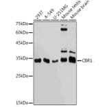 Western Blot - Anti-CBR1 Antibody [ARC2432] (A305656) - Antibodies.com