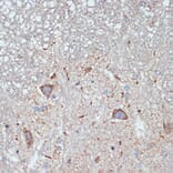 Immunohistochemistry - Anti-CBR1 Antibody [ARC2432] (A305656) - Antibodies.com