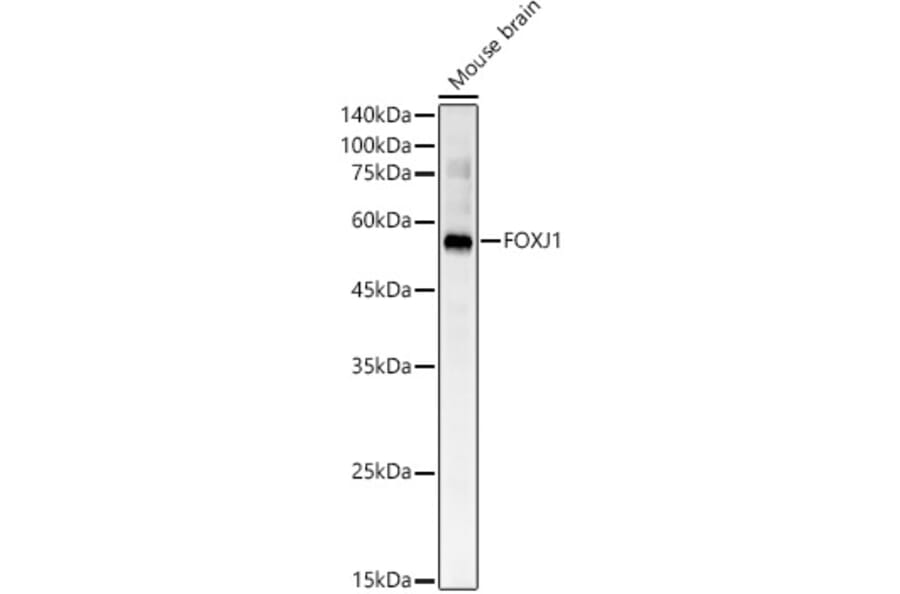 Western Blot - Anti-FoxJ1 Antibody (A305658) - Antibodies.com