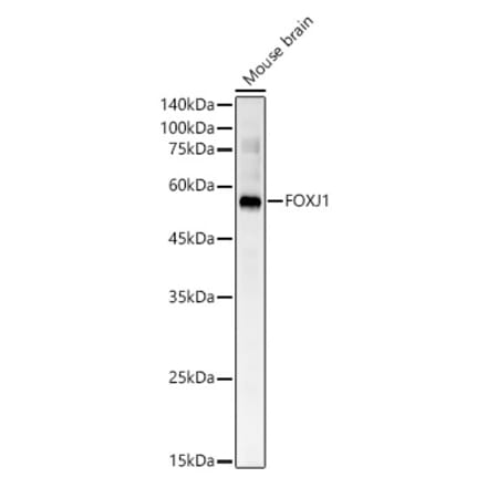 Western Blot - Anti-FoxJ1 Antibody (A305658) - Antibodies.com