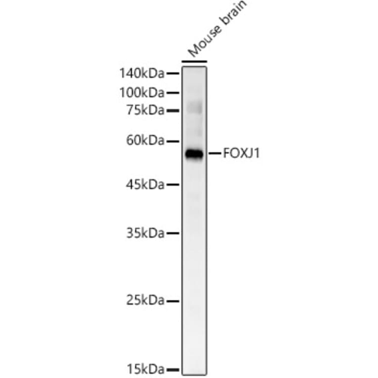 Western Blot - Anti-FoxJ1 Antibody (A305658) - Antibodies.com