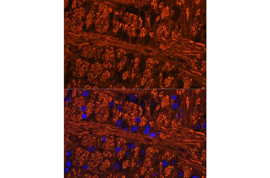Immunofluorescence - Anti-Tau (phospho Ser404) Antibody (A305659) - Antibodies.com