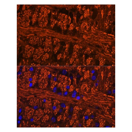 Immunofluorescence - Anti-Tau (phospho Ser404) Antibody (A305659) - Antibodies.com