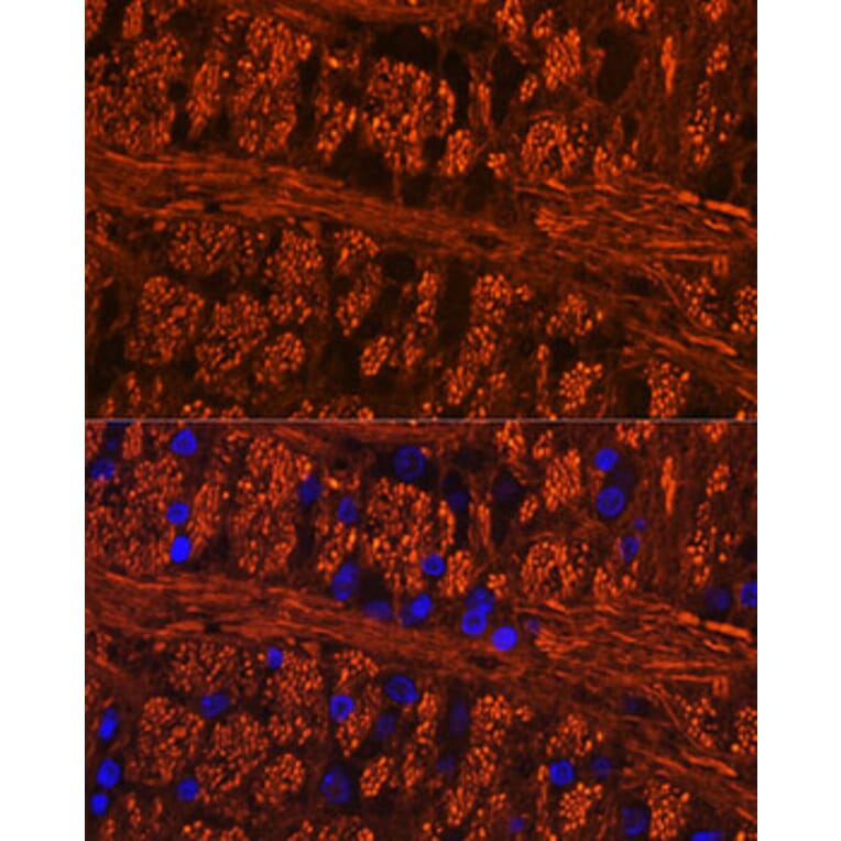 Immunofluorescence - Anti-Tau (phospho Ser404) Antibody (A305659) - Antibodies.com