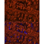 Immunofluorescence - Anti-Tau (phospho Ser404) Antibody (A305659) - Antibodies.com