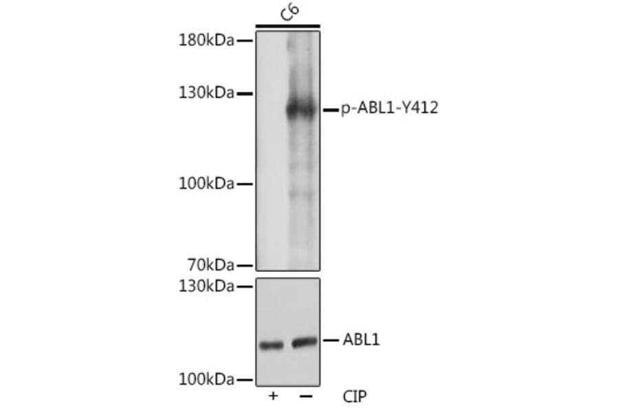 Western Blot - Anti-ABL1 (phospho Tyr412) Antibody (A305660) - Antibodies.com