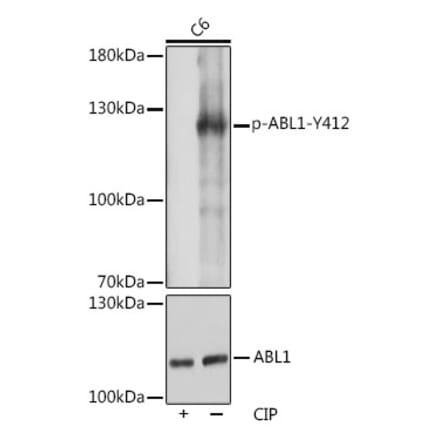 Western Blot - Anti-ABL1 (phospho Tyr412) Antibody (A305660) - Antibodies.com