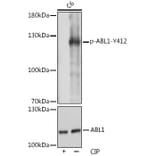 Western Blot - Anti-ABL1 (phospho Tyr412) Antibody (A305660) - Antibodies.com