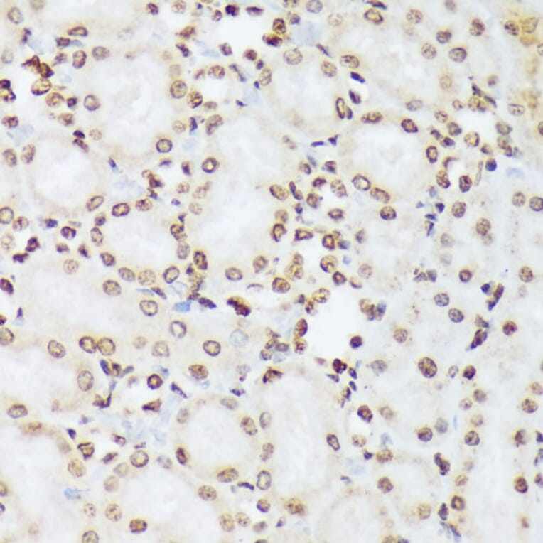 Immunohistochemistry - Anti-ABL1 (phospho Tyr412) Antibody (A305660) - Antibodies.com