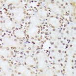 Immunohistochemistry - Anti-ABL1 (phospho Tyr412) Antibody (A305660) - Antibodies.com