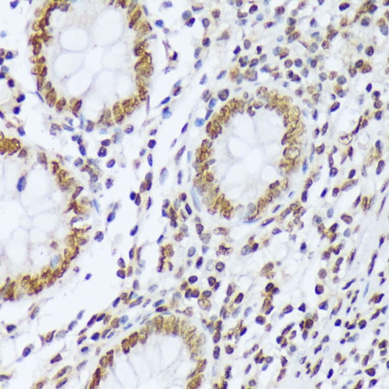 Immunohistochemistry - Anti-ABL1 (phospho Tyr412) Antibody (A305660) - Antibodies.com