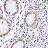 Immunohistochemistry - Anti-ABL1 (phospho Tyr412) Antibody (A305660) - Antibodies.com