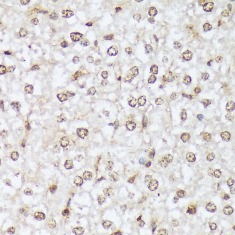 Immunohistochemistry - Anti-ABL1 (phospho Tyr412) Antibody (A305660) - Antibodies.com