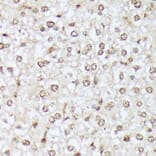 Immunohistochemistry - Anti-ABL1 (phospho Tyr412) Antibody (A305660) - Antibodies.com