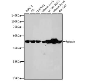 Western Blot - Anti-Fukutin Antibody [ARC2559] (A305661) - Antibodies.com