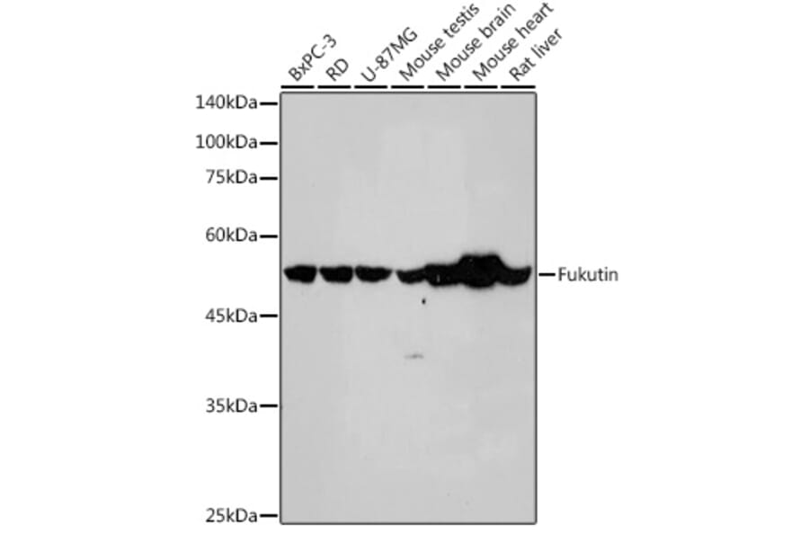 Western Blot - Anti-Fukutin Antibody [ARC2559] (A305661) - Antibodies.com