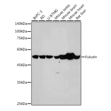 Western Blot - Anti-Fukutin Antibody [ARC2559] (A305661) - Antibodies.com