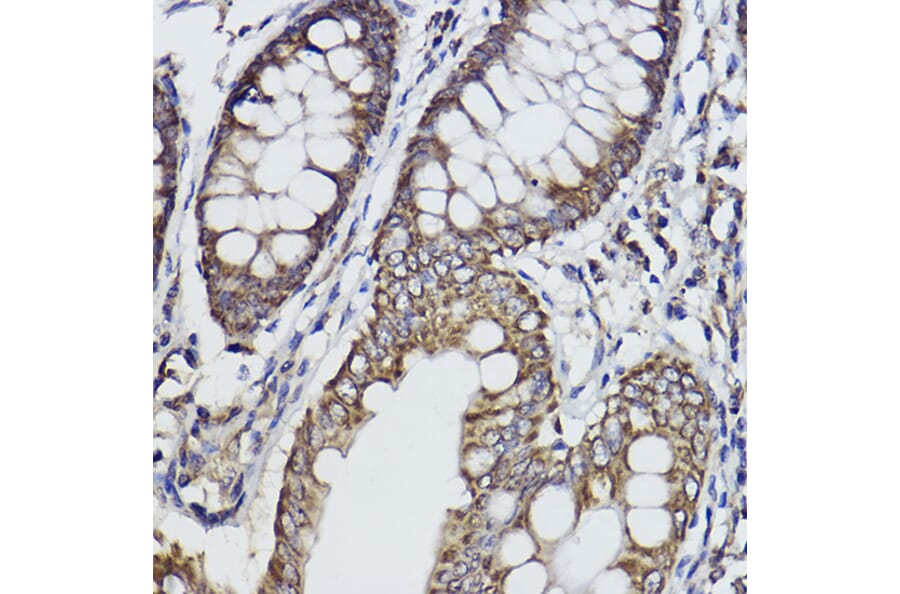 Immunohistochemistry - Anti-Fukutin Antibody [ARC2559] (A305661) - Antibodies.com