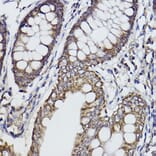 Immunohistochemistry - Anti-Fukutin Antibody [ARC2559] (A305661) - Antibodies.com