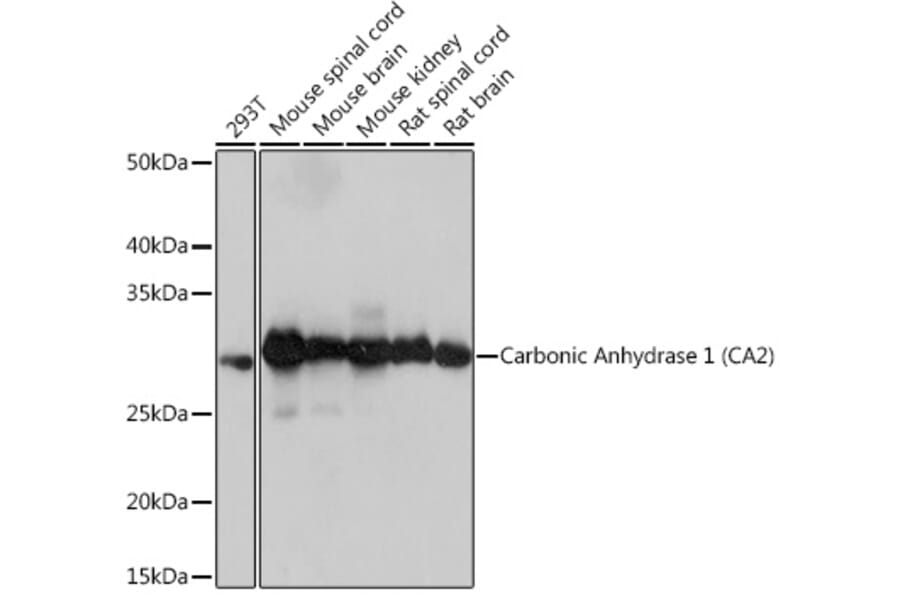 Western Blot - Anti-Carbonic anhydrase 2/CA2 Antibody [ARC1451] (A305662) - Antibodies.com