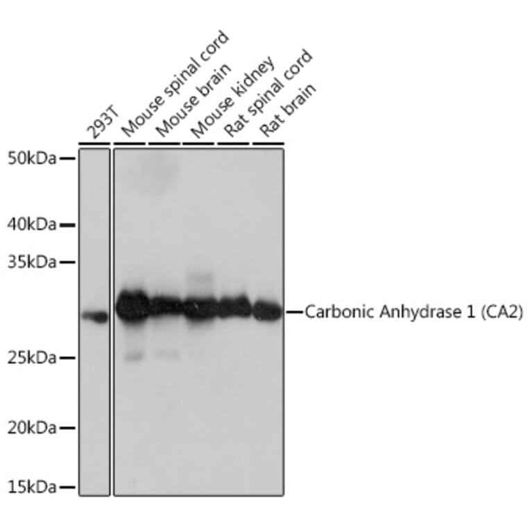 Western Blot - Anti-Carbonic anhydrase 2/CA2 Antibody [ARC1451] (A305662) - Antibodies.com