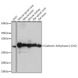 Western Blot - Anti-Carbonic anhydrase 2/CA2 Antibody [ARC1451] (A305662) - Antibodies.com