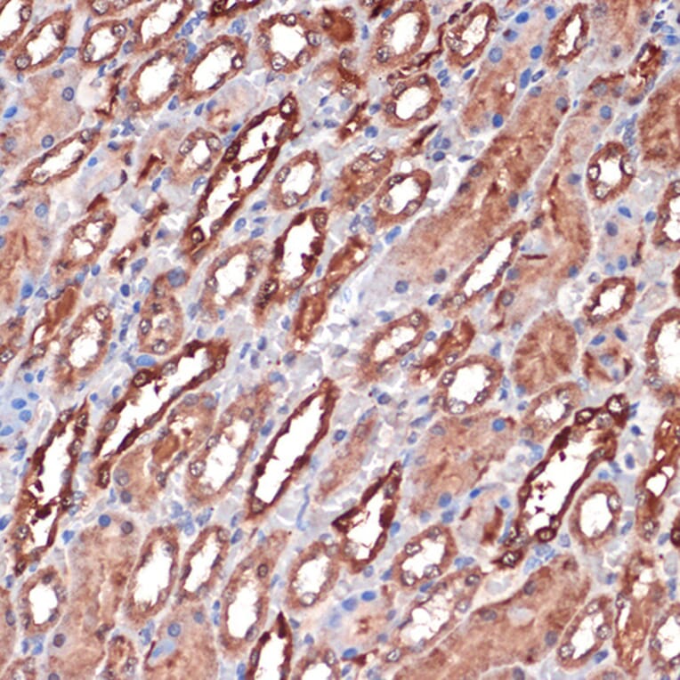 Immunohistochemistry - Anti-Carbonic anhydrase 2/CA2 Antibody [ARC1451] (A305662) - Antibodies.com