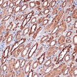 Immunohistochemistry - Anti-Carbonic anhydrase 2/CA2 Antibody [ARC1451] (A305662) - Antibodies.com