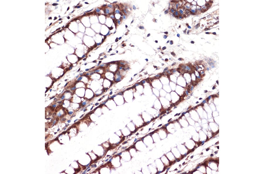 Immunohistochemistry - Anti-Carbonic anhydrase 2/CA2 Antibody [ARC1451] (A305662) - Antibodies.com