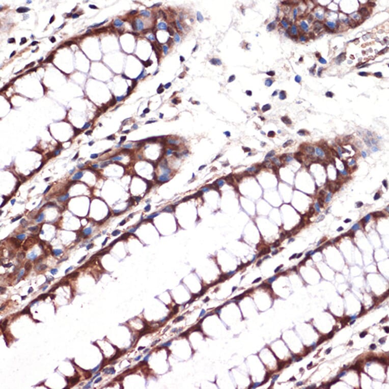 Immunohistochemistry - Anti-Carbonic anhydrase 2/CA2 Antibody [ARC1451] (A305662) - Antibodies.com