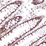 Immunohistochemistry - Anti-Carbonic anhydrase 2/CA2 Antibody [ARC1451] (A305662) - Antibodies.com