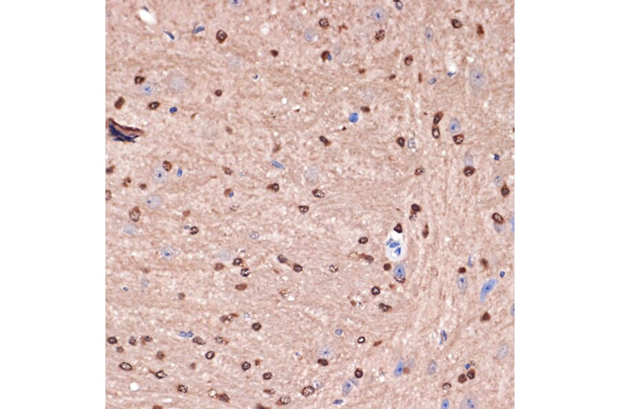 Immunohistochemistry - Anti-Carbonic anhydrase 2/CA2 Antibody [ARC1451] (A305662) - Antibodies.com