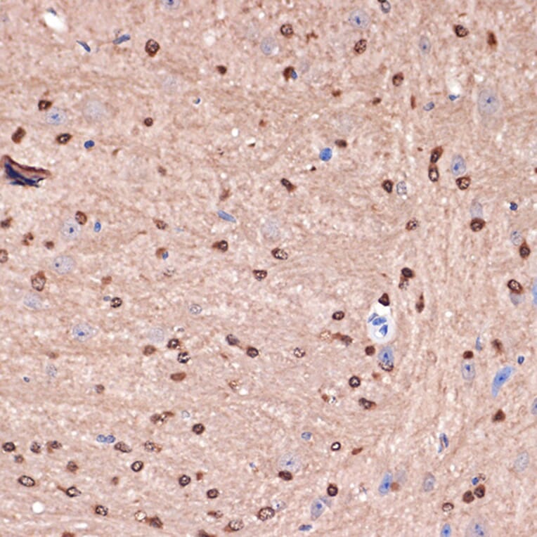 Immunohistochemistry - Anti-Carbonic anhydrase 2/CA2 Antibody [ARC1451] (A305662) - Antibodies.com