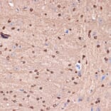 Immunohistochemistry - Anti-Carbonic anhydrase 2/CA2 Antibody [ARC1451] (A305662) - Antibodies.com