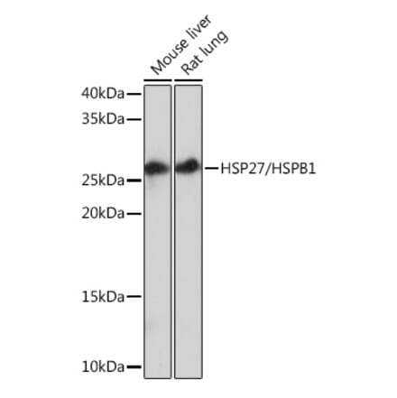Western Blot - Anti-Hsp27 Antibody [ARC0531] (A305664) - Antibodies.com
