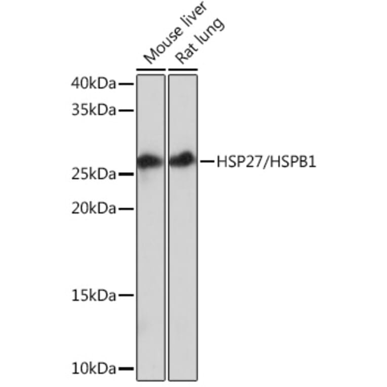 Western Blot - Anti-Hsp27 Antibody [ARC0531] (A305664) - Antibodies.com