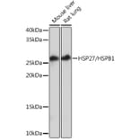 Western Blot - Anti-Hsp27 Antibody [ARC0531] (A305664) - Antibodies.com