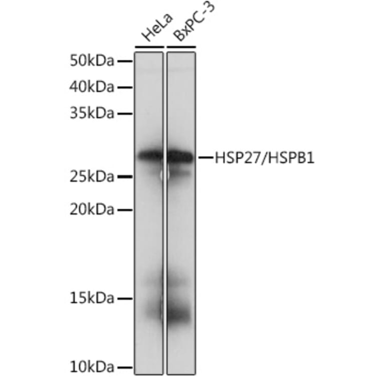 Western Blot - Anti-Hsp27 Antibody [ARC0531] (A305664) - Antibodies.com