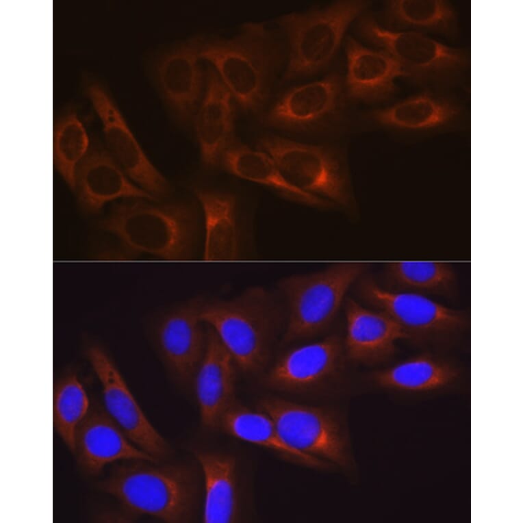 Immunofluorescence - Anti-Hsp27 Antibody [ARC0531] (A305664) - Antibodies.com