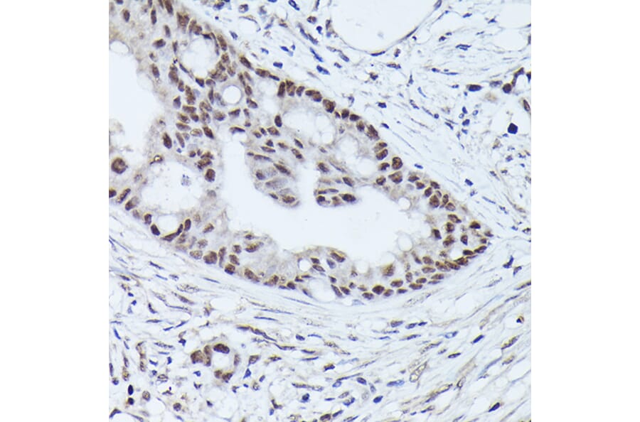 Immunohistochemistry - Anti-WDR46 Antibody (A305665) - Antibodies.com