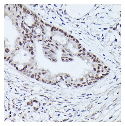 Immunohistochemistry - Anti-WDR46 Antibody (A305665) - Antibodies.com