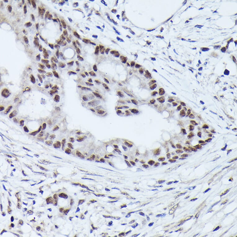 Immunohistochemistry - Anti-WDR46 Antibody (A305665) - Antibodies.com